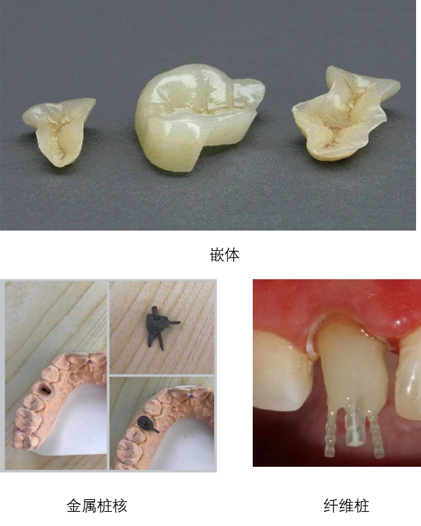 牙齿缺损修复方法_牙齿缺损修复方法图片_牙齿缺损修复方法视频