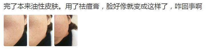 祛痘坑最好的方法_祛痘坑效果最好的方法_祛痘坑最新技术