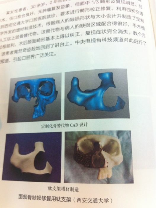 3d打印fdm技术_3D打印应用领域_3D打印技术原理