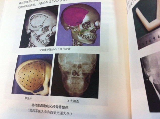 3d打印fdm技术_3D打印应用领域_3D打印技术原理
