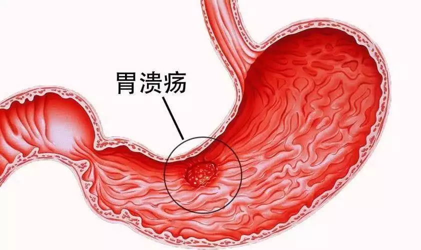 长期不吃晚饭的危害_晚上不吃饭能不能瘦_晚饭吃素菜减肥